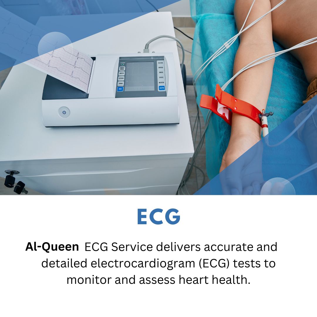 ECG