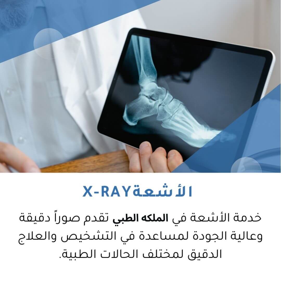 X-ray-ar